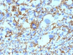 HLA DRB1 Antibody (SPM423), Novus Biologicals 0.2mg; Unlabeled:Antibodies,